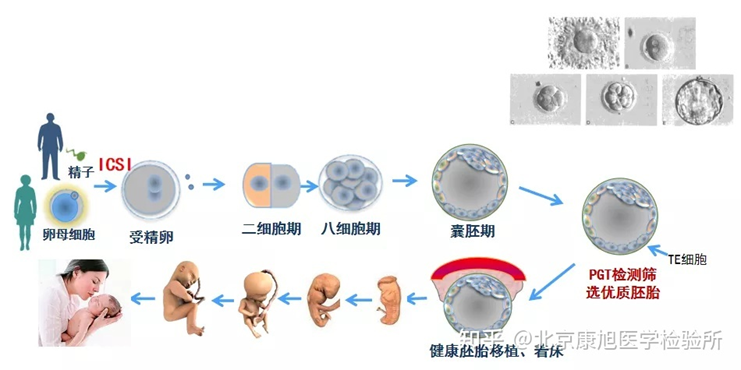 新一代试管婴儿技术发布！活产率提升至72%！