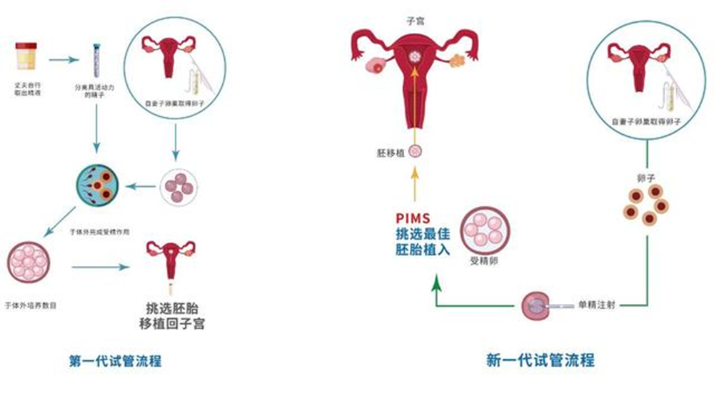 新一代试管婴儿技术发布！活产率提升至72%！